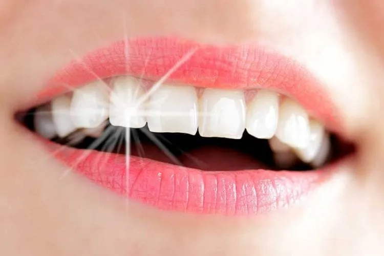 Teeth Whitening Cosmetic Dentistry | Palmer Park Dentistry